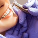 Выбираем лучший ортодонтический центр в Харькове